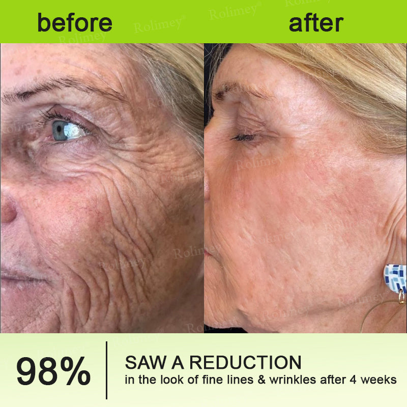 ✔Made and shipped from the USA 💫Rolimey® Botox & Vita-A Retinol Shot Wrinkle-Lift Tightening cream - Last Day Promotion 70% OFF