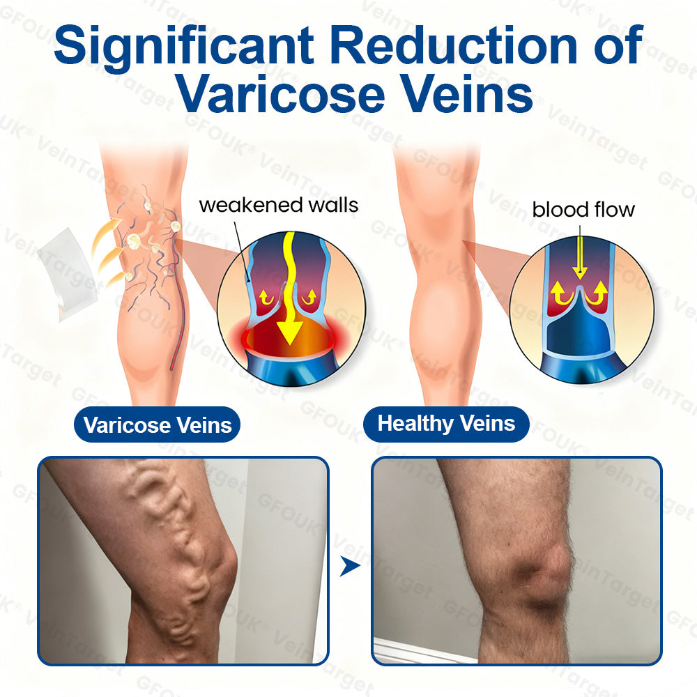 GFOUK® VeinTarget Microneedle Patch⚡Instant Relief, Long-Term Results