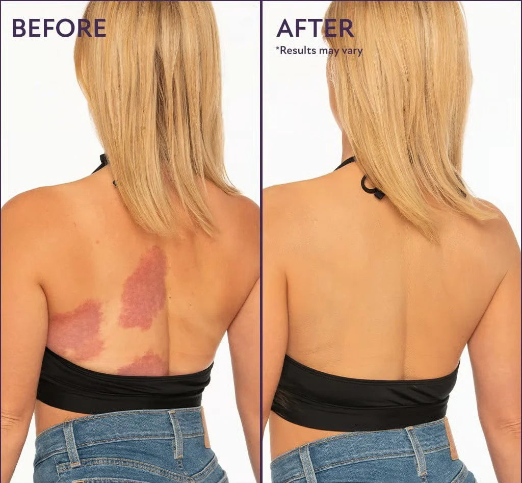 Final 3 Hours: 60%OFF-Evanesce Soft Matte Cream Concealer