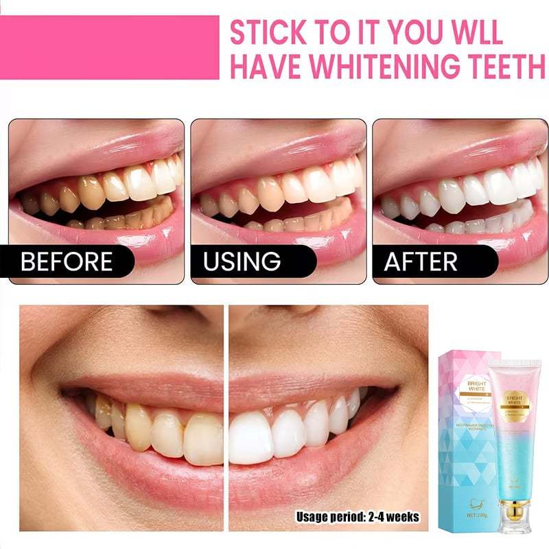 ✨ Achieve a Radiant Smile - 49% OFF - 🦷 Niacinamide Whitening Toothpaste - For Healthier, Whiter Teeth!
