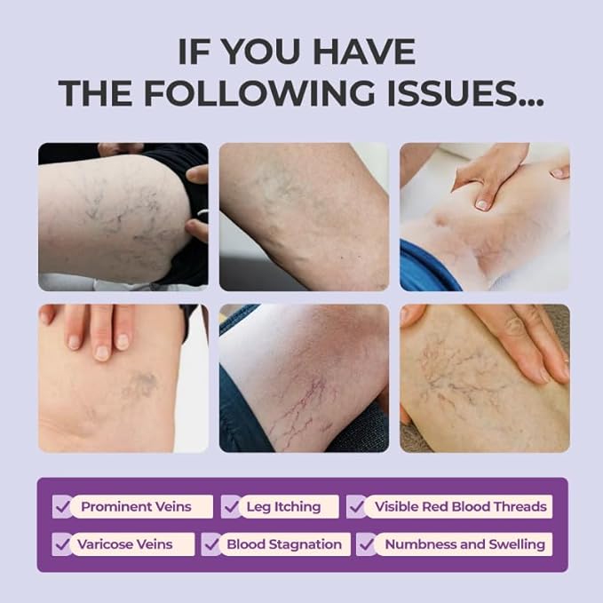 (🔥LAST DAY SALE - 80% OFF) AQA™ Leg Relief Varicose Veins Cream for Pain and Swelling Body Care Lotions Comfort Skin Care