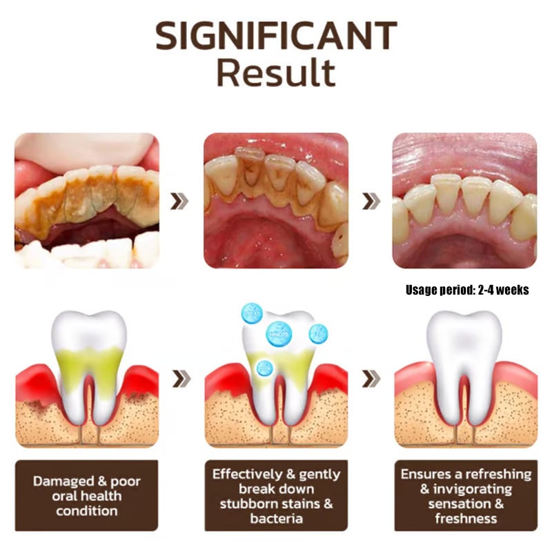 ✨ Achieve a Radiant Smile - 49% OFF - 🦷 Niacinamide Whitening Toothpaste - For Healthier, Whiter Teeth!