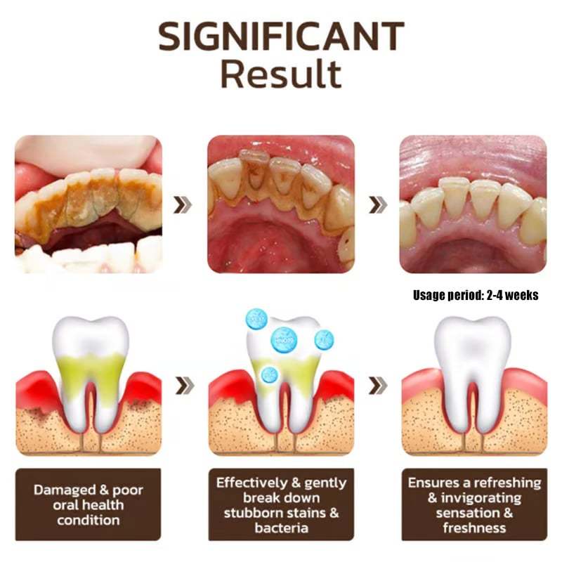 ✨ Achieve a Radiant Smile - 49% OFF - 🦷 Niacinamide Whitening Toothpaste - For Healthier, Whiter Teeth!