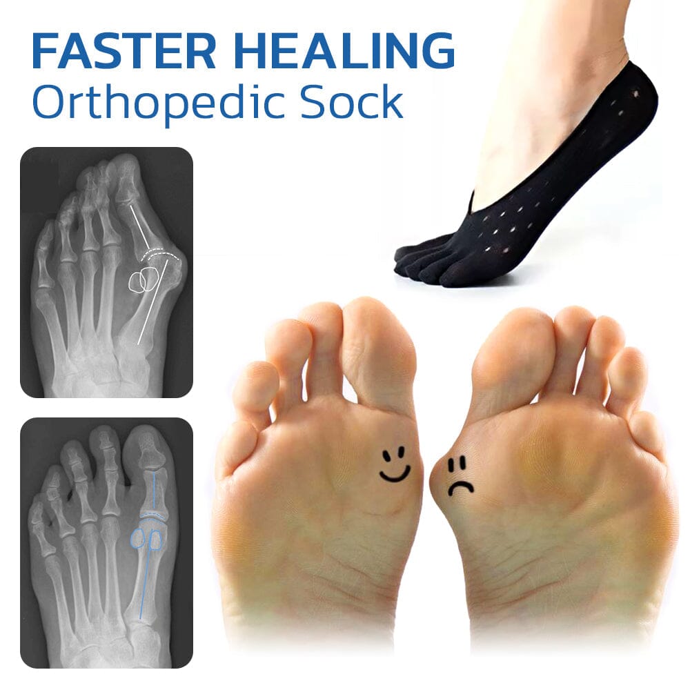 Orthopedic Bunion Relief Socks