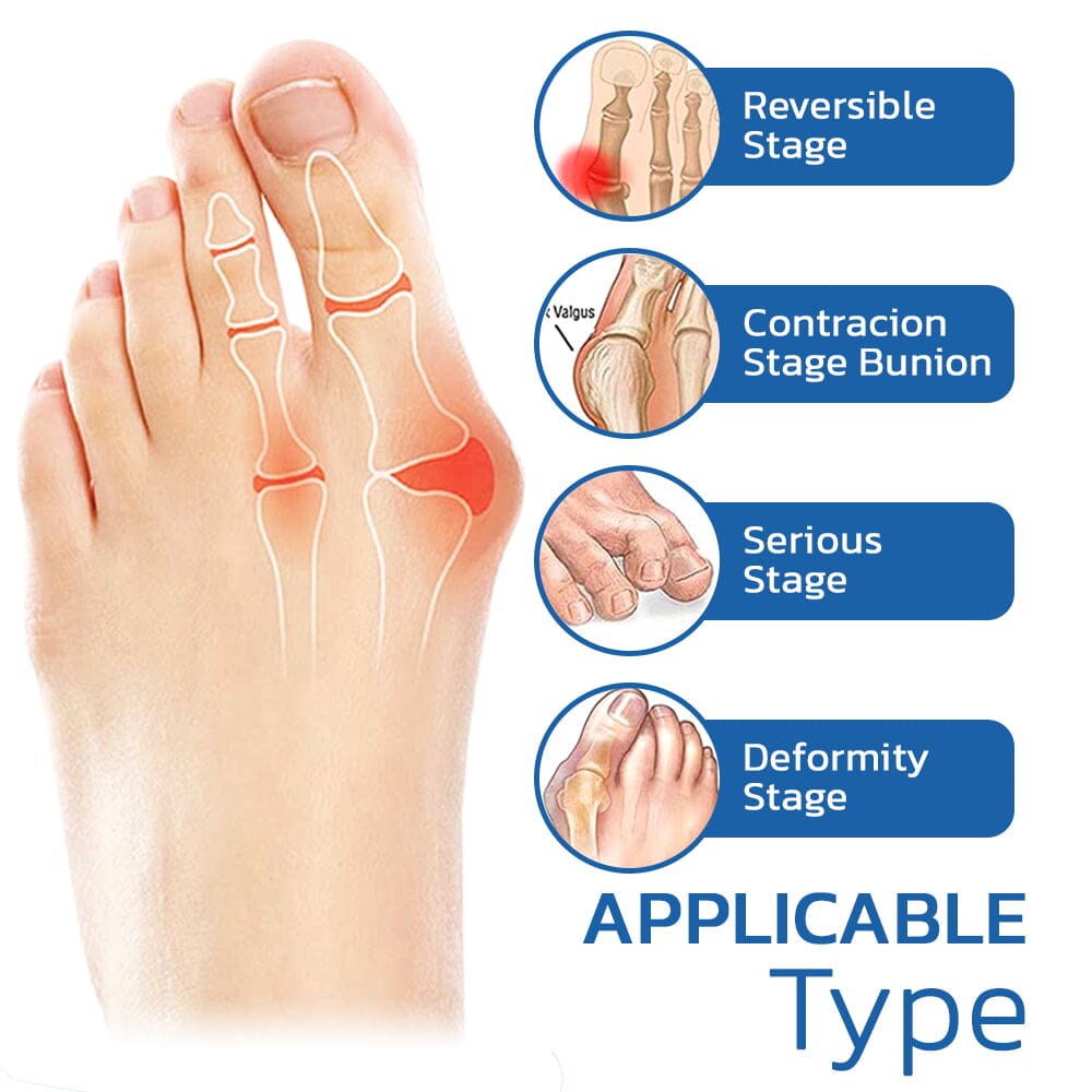 Orthopedic Bunion Relief Socks