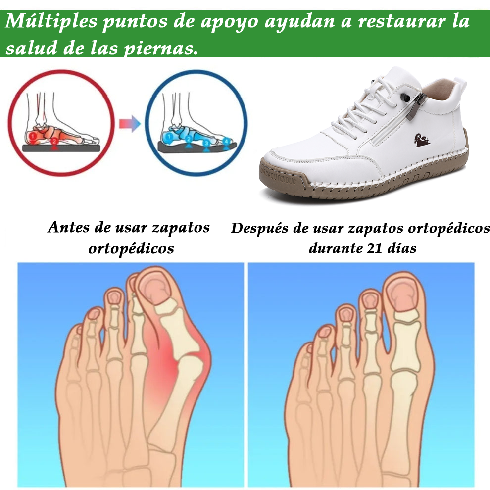 (🔥 50% off - Don't miss out!) Selected calfskin leather shoes - Orthopedic shoes - 👞 - Durable, non-slip, and waterproof (arch support, pain relief, unisex)