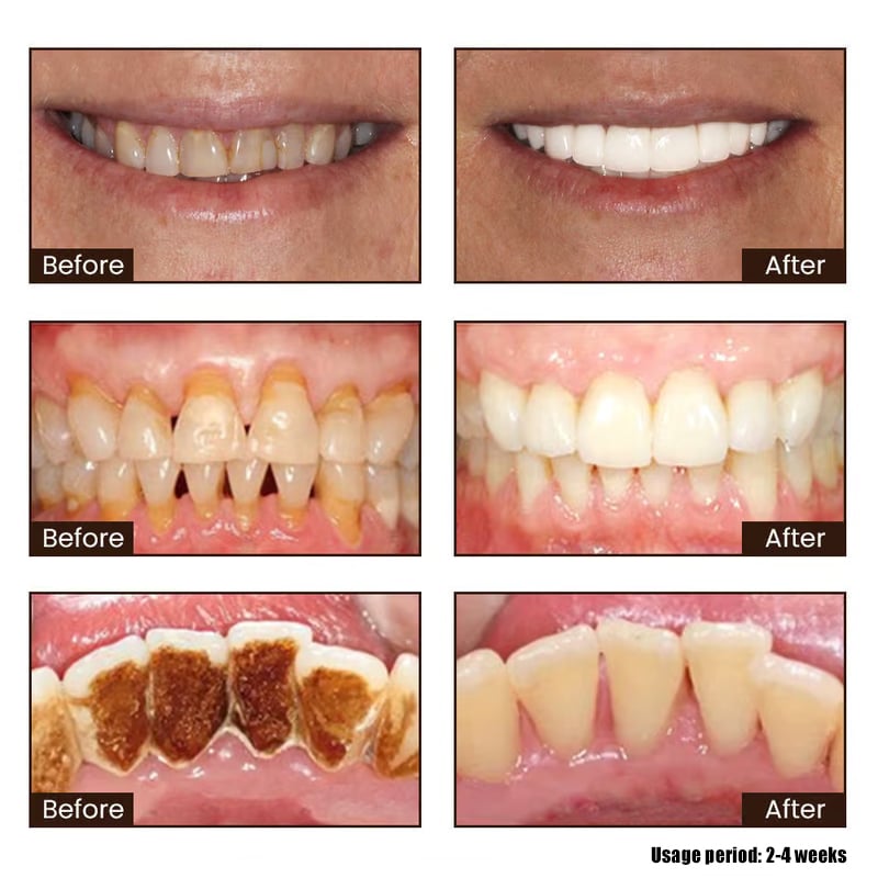 ✨ Achieve a Radiant Smile - 49% OFF - 🦷 Niacinamide Whitening Toothpaste - For Healthier, Whiter Teeth!