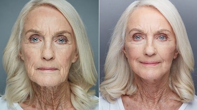 英80歲老婦冒險拉皮「至少可以美美地進棺材」 - 國際- 自由時報電子報