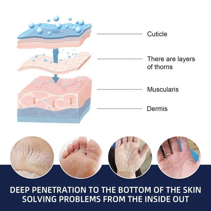 3Pack Cracked Foot Heel Treatment 