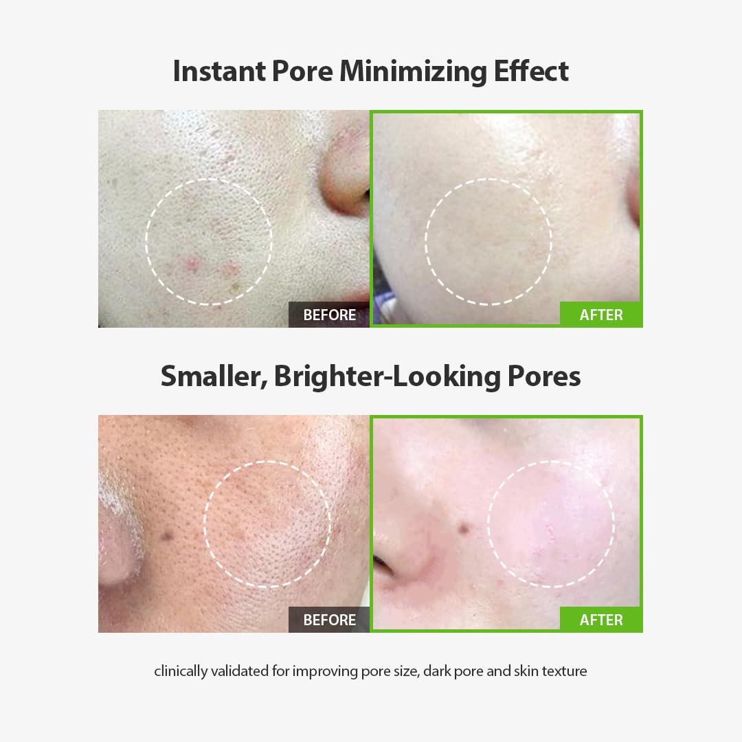 ✨Green tomato pore repair essence