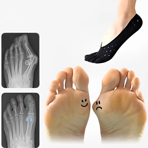 Bunion Corrective Toe Socks