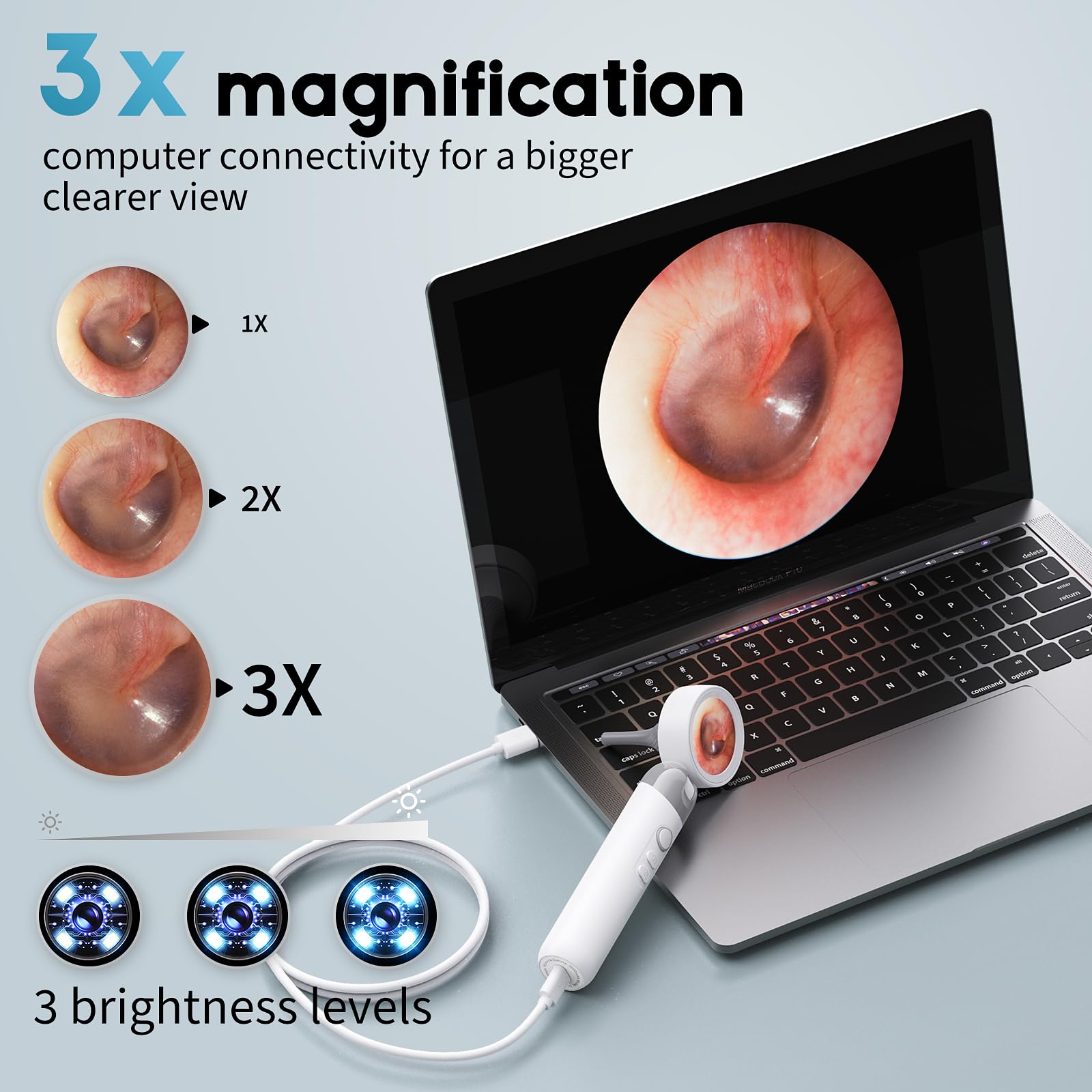 1080P HD Digital Otoscope with 1.38" Screen