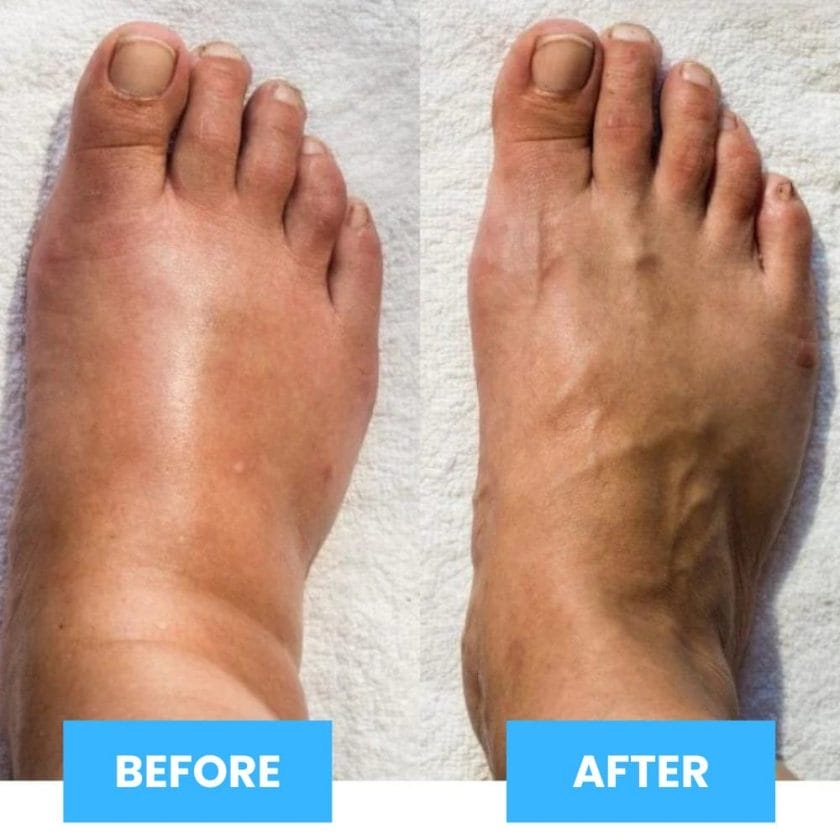 EMS Foot Massager - Experience Long-Term Foot Pain Relief with Only 15 Minutes per Day