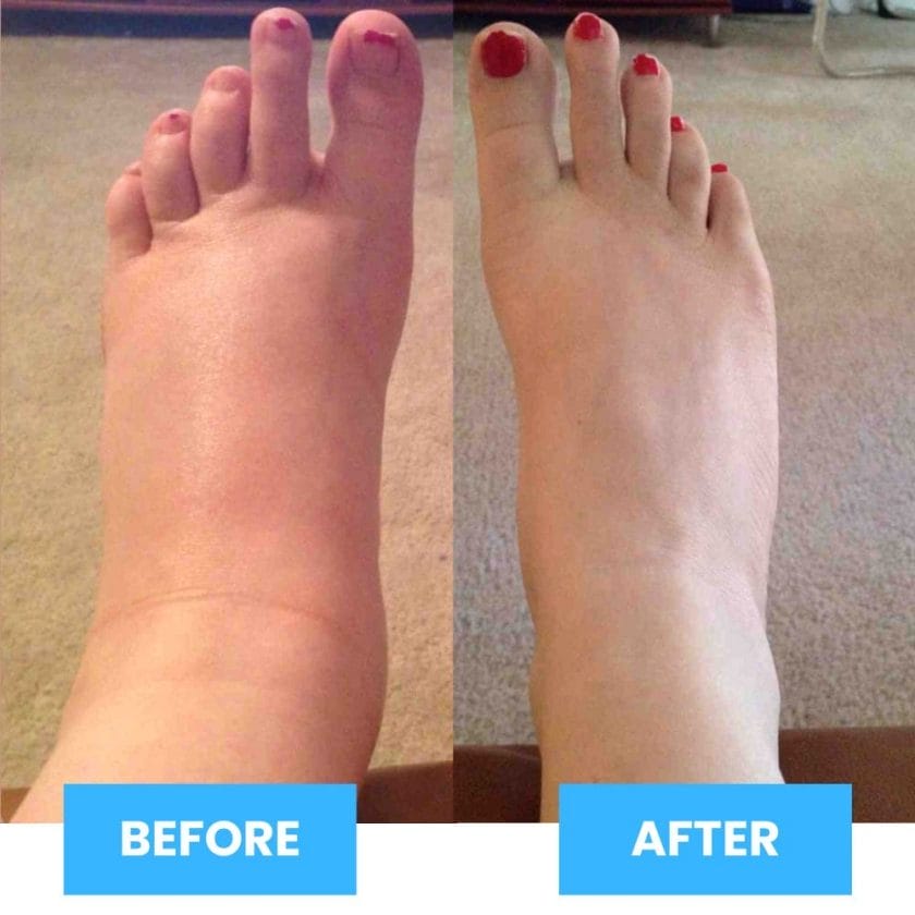 EMS Foot Massager - Experience Long-Term Foot Pain Relief with Only 15 Minutes per Day