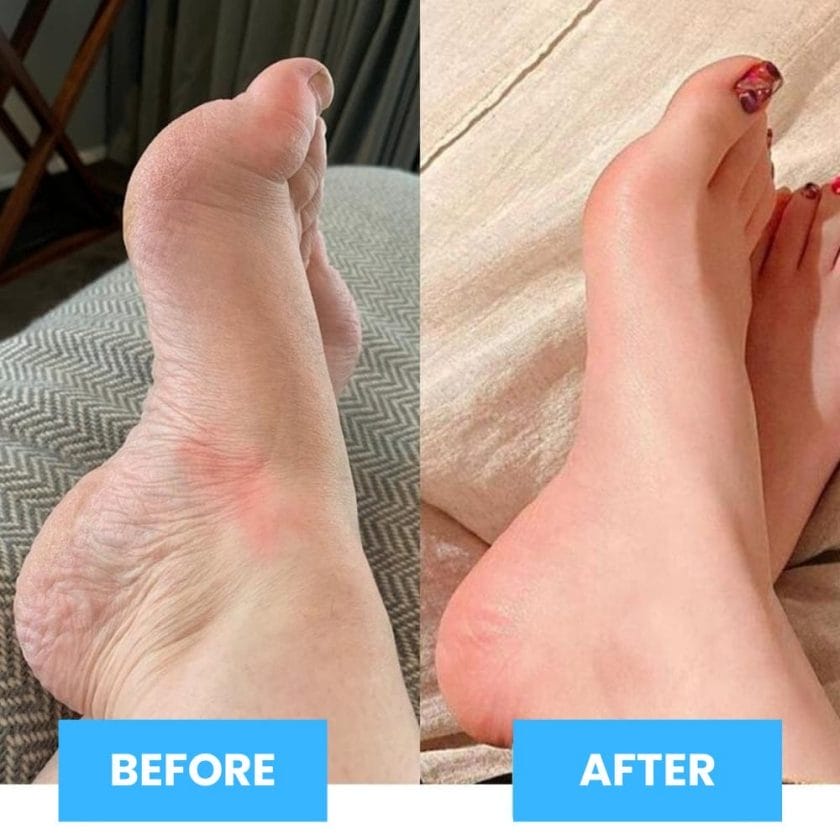 EMS Foot Massager - Experience Long-Term Foot Pain Relief with Only 15 Minutes per Day