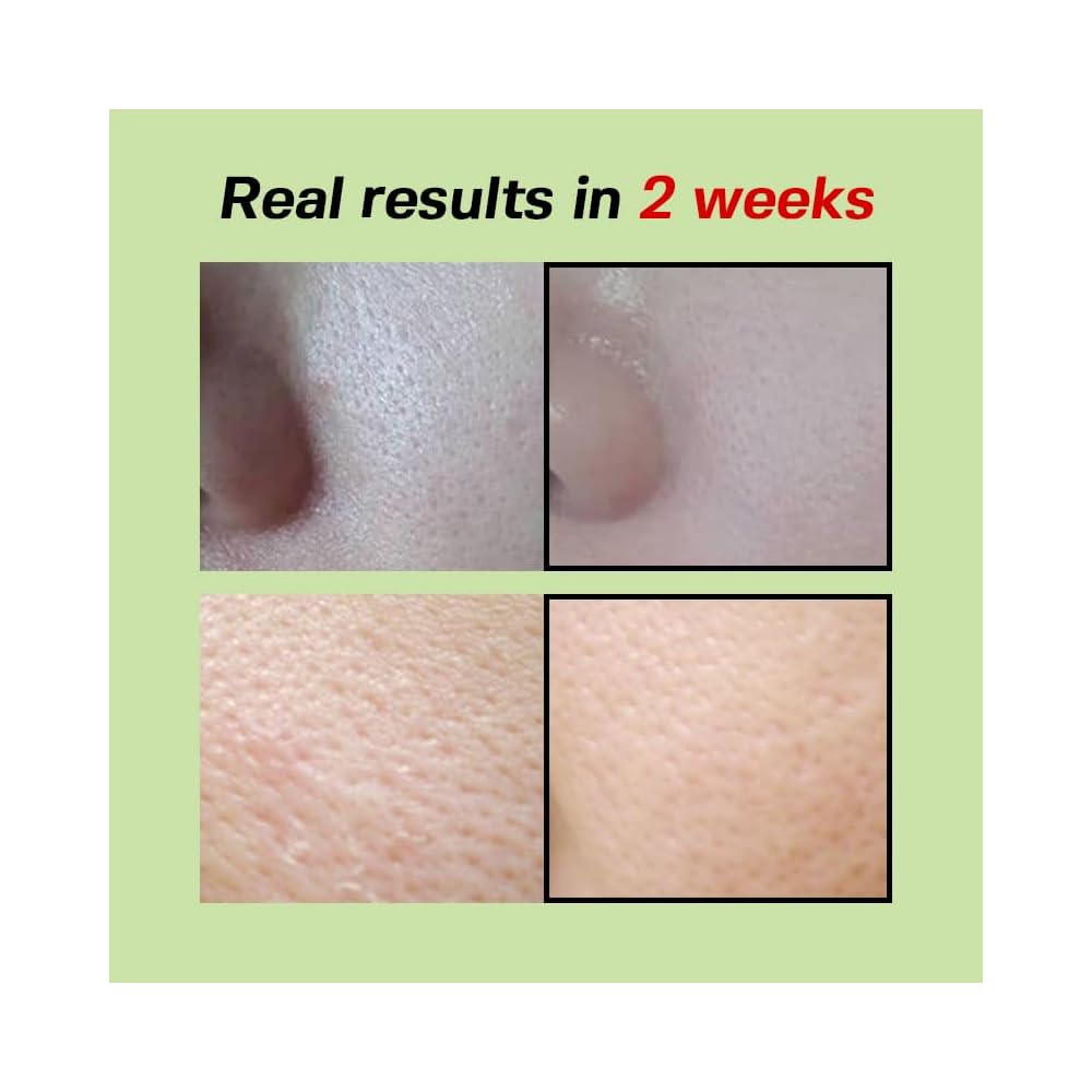 ✨Green tomato pore repair essence