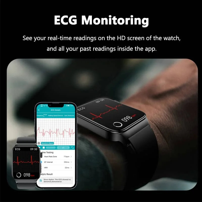 2024 NEW E500 ECG Smart Watch with Blood Pressure Monitor Body Temperature Blood Glucose Heart Rate Blood Oxygen