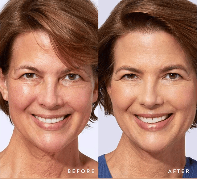 🔥2025 SALE 49% OFF🎁Colour Changing Mature Skin Foundation🎁