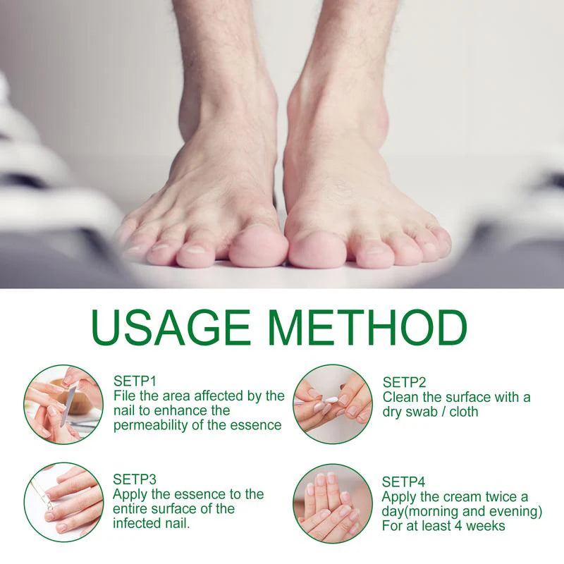 Ginger Nail Treatment Nail Support Nail Care👨‍⚕️