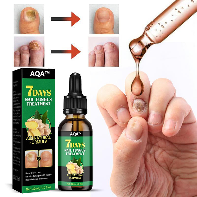 Ginger Nail Treatment Nail Support Nail Care👨‍⚕️