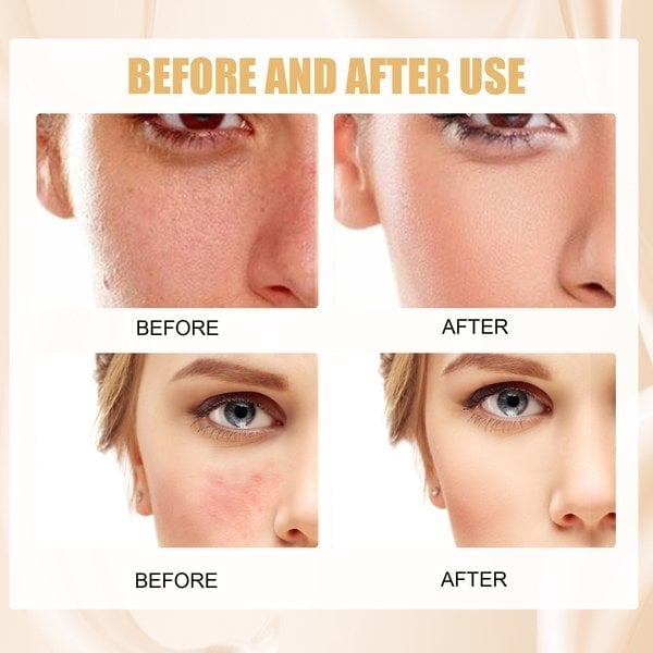 🔥2025 SALE 49% OFF🎁Colour Changing Mature Skin Foundation🎁