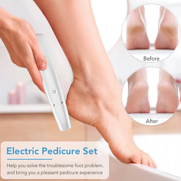 🥳2026 HOT SALE🥳💞50K+ SOLD!💥🎁✨ 50% OFF! Electric Feet Callus Remover – 360° roller, 3 speeds. Safe for dry & wet use. USB rechargeable, 100 mins runtime. Baby‑soft feet at home. 🦶💨