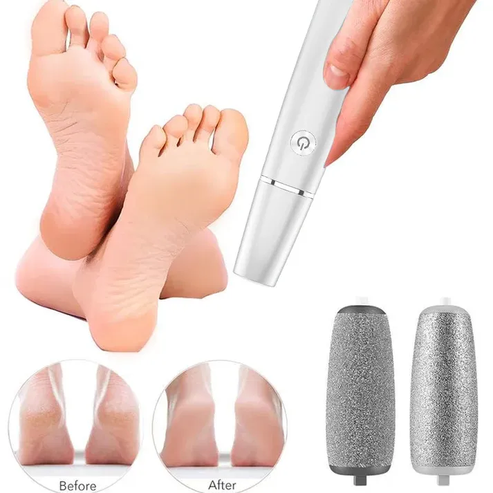 🥳2026 HOT SALE🥳💞50K+ SOLD!💥🎁✨ 50% OFF! Electric Feet Callus Remover – 360° roller, 3 speeds. Safe for dry & wet use. USB rechargeable, 100 mins runtime. Baby‑soft feet at home. 🦶💨