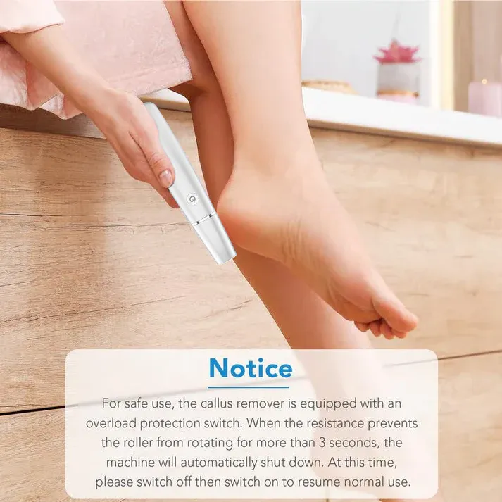 🥳2026 HOT SALE🥳💞50K+ SOLD!💥🎁✨ 50% OFF! Electric Feet Callus Remover – 360° roller, 3 speeds. Safe for dry & wet use. USB rechargeable, 100 mins runtime. Baby‑soft feet at home. 🦶💨
