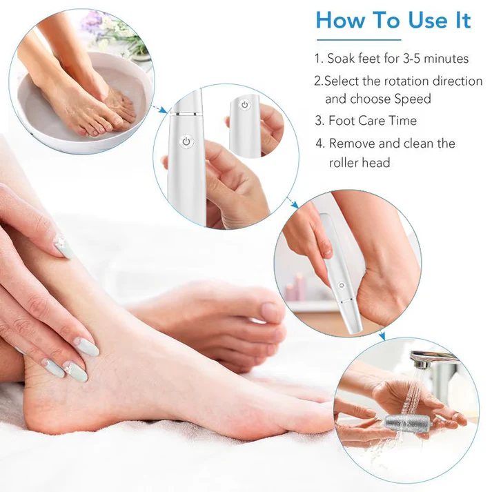 🥳2026 HOT SALE🥳💞50K+ SOLD!💥🎁✨ 50% OFF! Electric Feet Callus Remover – 360° roller, 3 speeds. Safe for dry & wet use. USB rechargeable, 100 mins runtime. Baby‑soft feet at home. 🦶💨