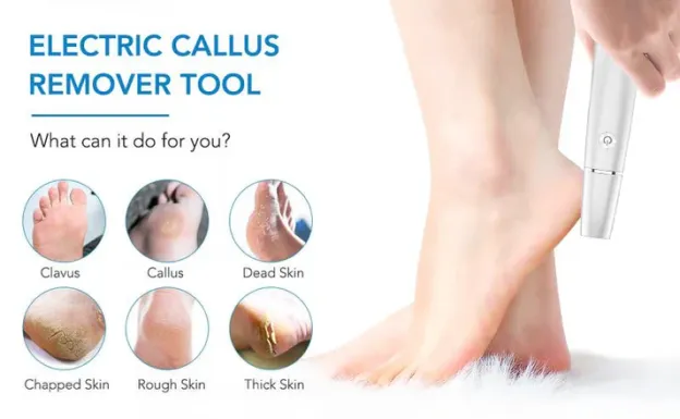 🥳2026 HOT SALE🥳💞50K+ SOLD!💥🎁✨ 50% OFF! Electric Feet Callus Remover – 360° roller, 3 speeds. Safe for dry & wet use. USB rechargeable, 100 mins runtime. Baby‑soft feet at home. 🦶💨