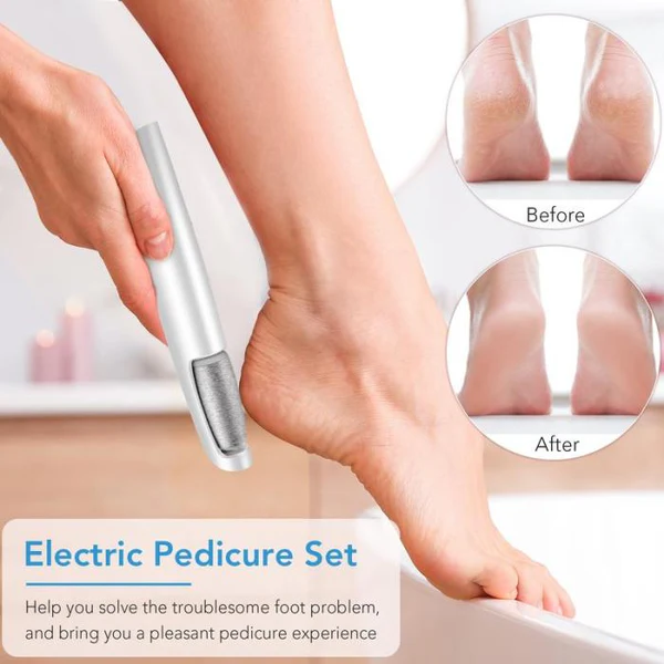 🥳2026 HOT SALE🥳💞50K+ SOLD!💥🎁✨ 50% OFF! Electric Feet Callus Remover – 360° roller, 3 speeds. Safe for dry & wet use. USB rechargeable, 100 mins runtime. Baby‑soft feet at home. 🦶💨