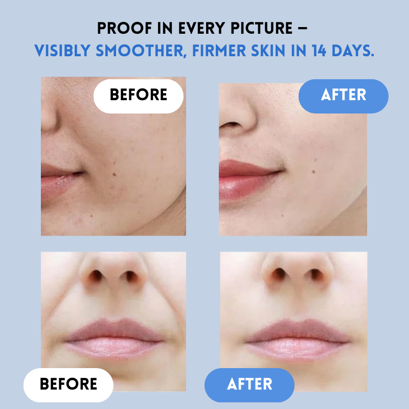 FirmPatch™ Αυτοπεποίθηση Χωρίς Ρυτίδες