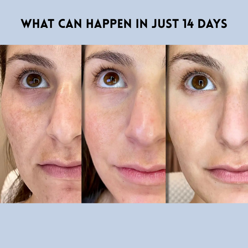 FirmPatch™ Αυτοπεποίθηση Χωρίς Ρυτίδες