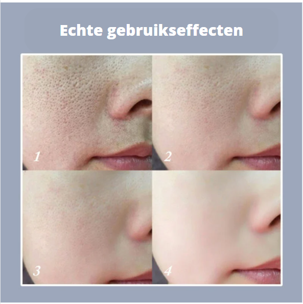 Αγοράστε 1, πάρτε 1 ΔΩΡΕΑΝ | PoreVeil® | Το φίλτρο ομορφιάς σας σε μορφή στυλό – Χωρίς πόρους σε δευτερόλεπτα ✨