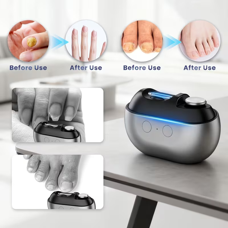 Painless Smart Nail Clipper(Suitable for all nails)