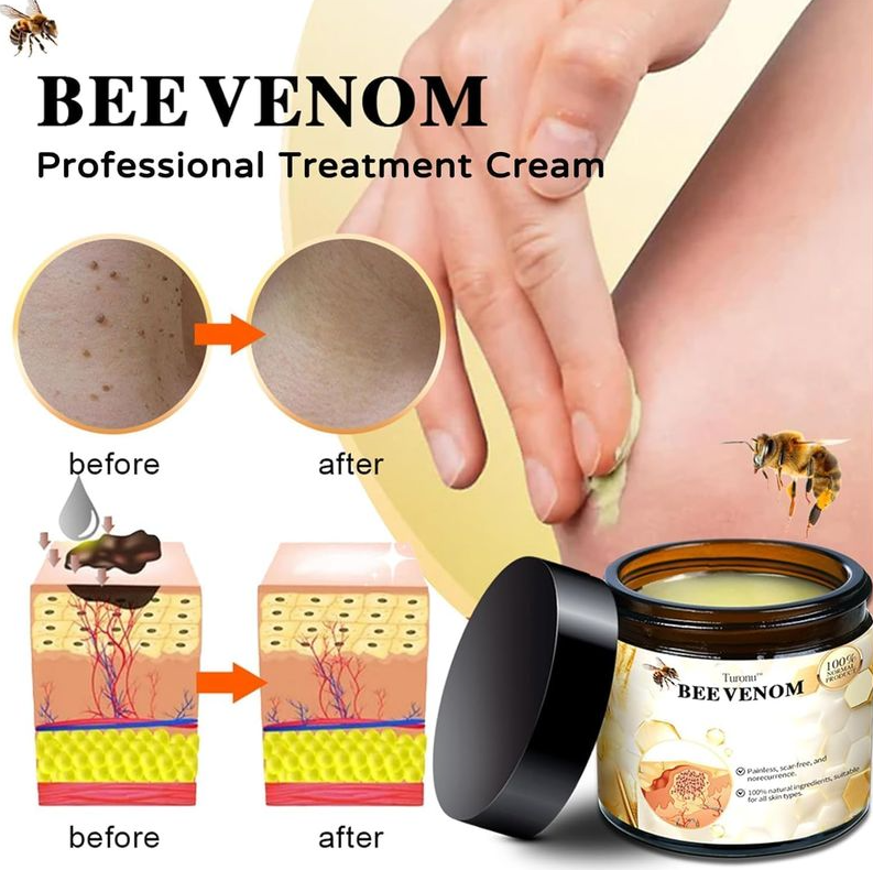 Turonu Bee Venom Treatment Cream, 2024 New Bee Venom Treatment Gel, Professional Bee Venom Repair Cream for All Skin Types (1Pcs)             