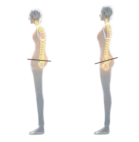 Posture