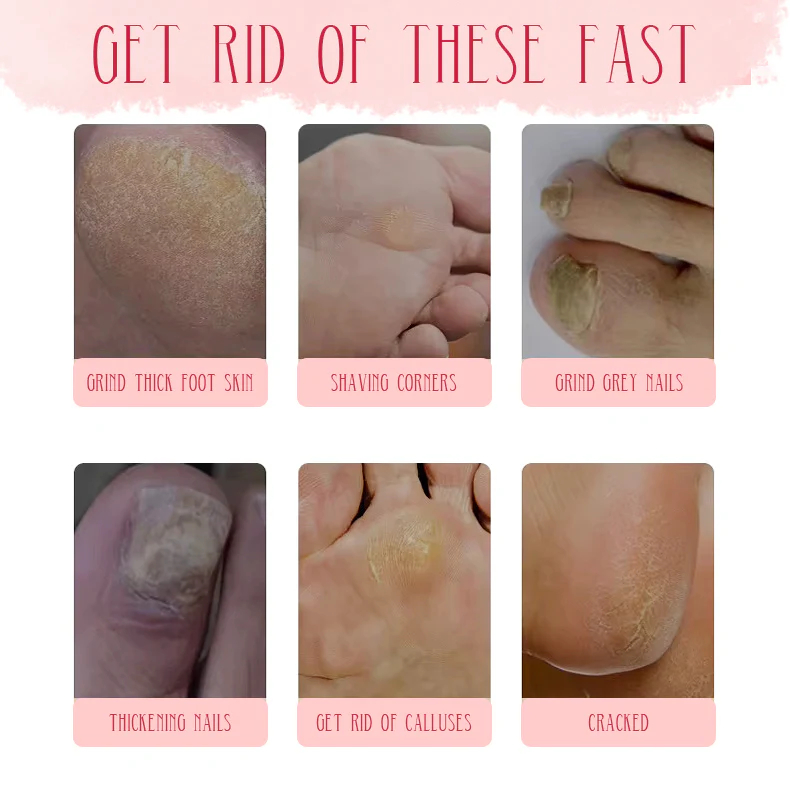 Electric Foot Grinder