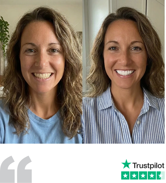 Alexandra's brighter, whiter smile after using Asuno, with her 5-star Trustpilot rating