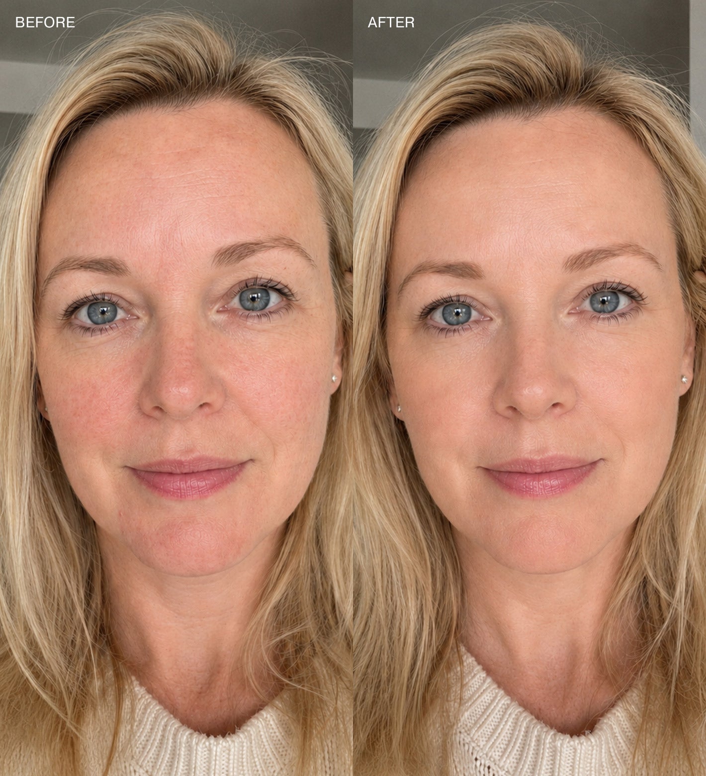 Changing Foundation before and after