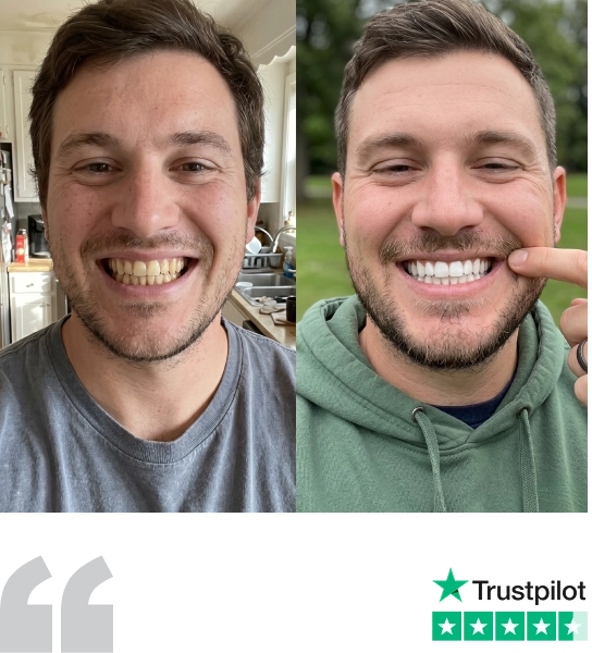 Chris's whiter teeth after using Asuno, with his 5-star Trustpilot rating