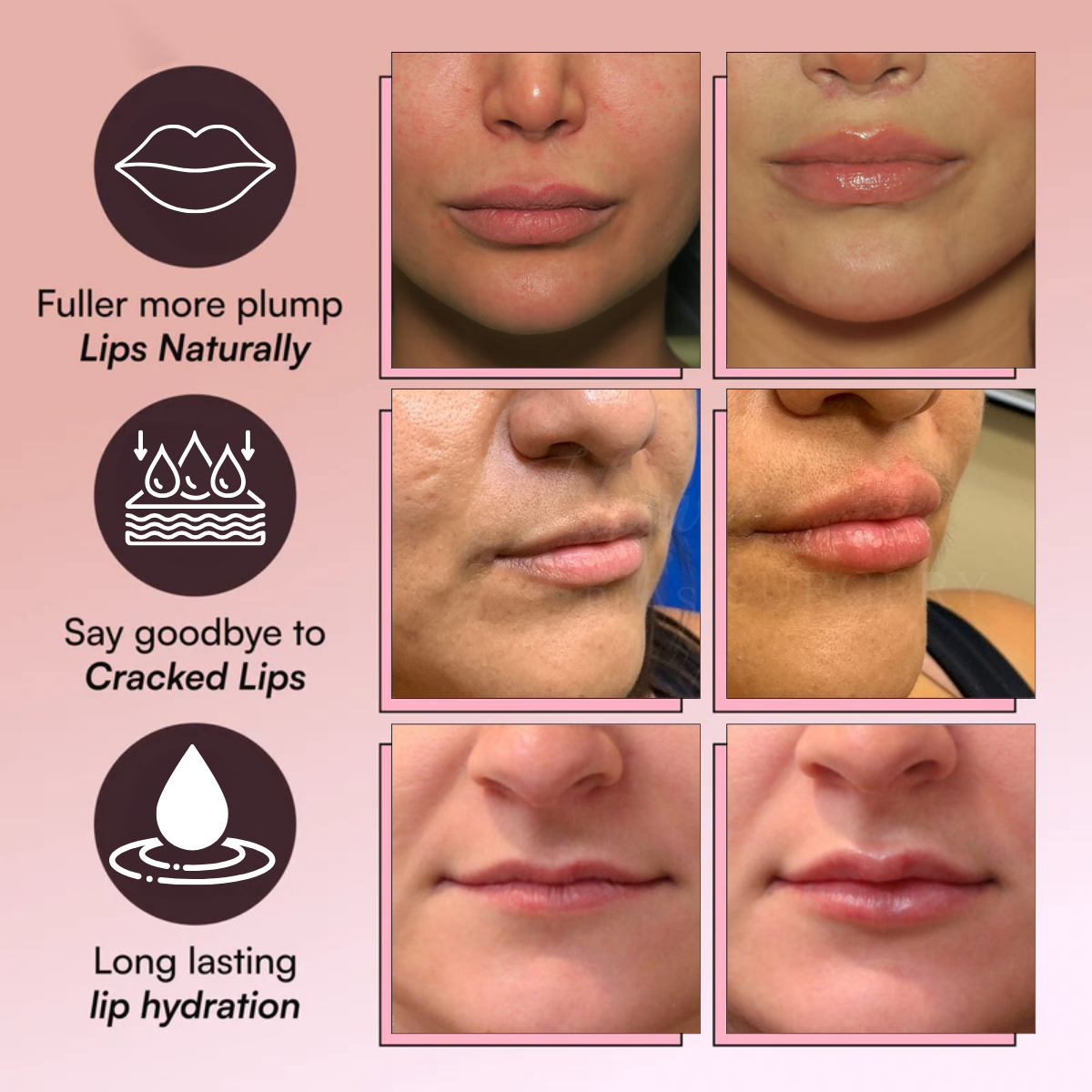 Natural Plump Roller Kit