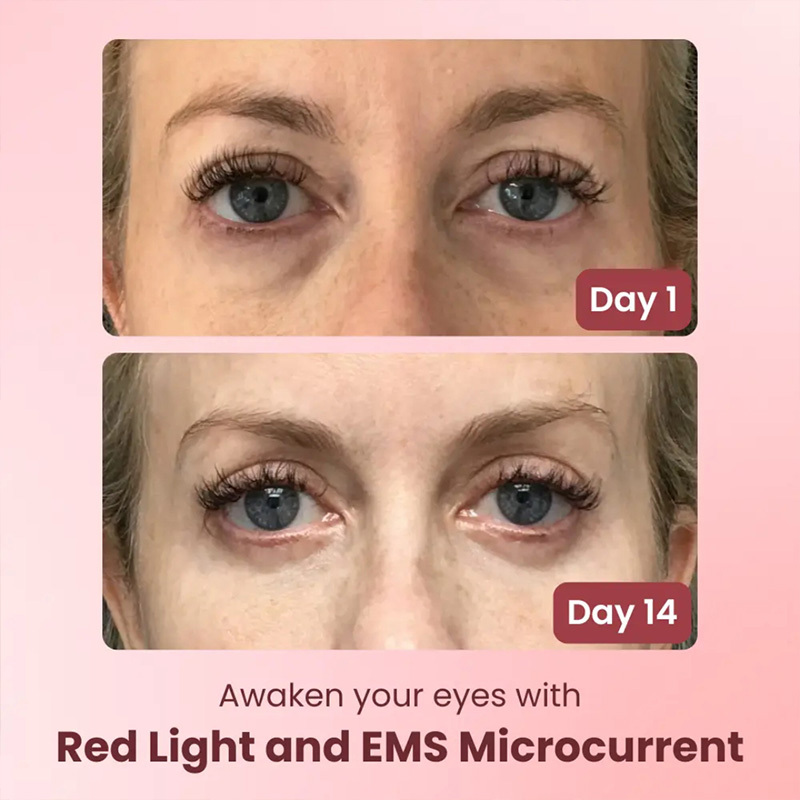 EMS Microcurrent Eye Massager