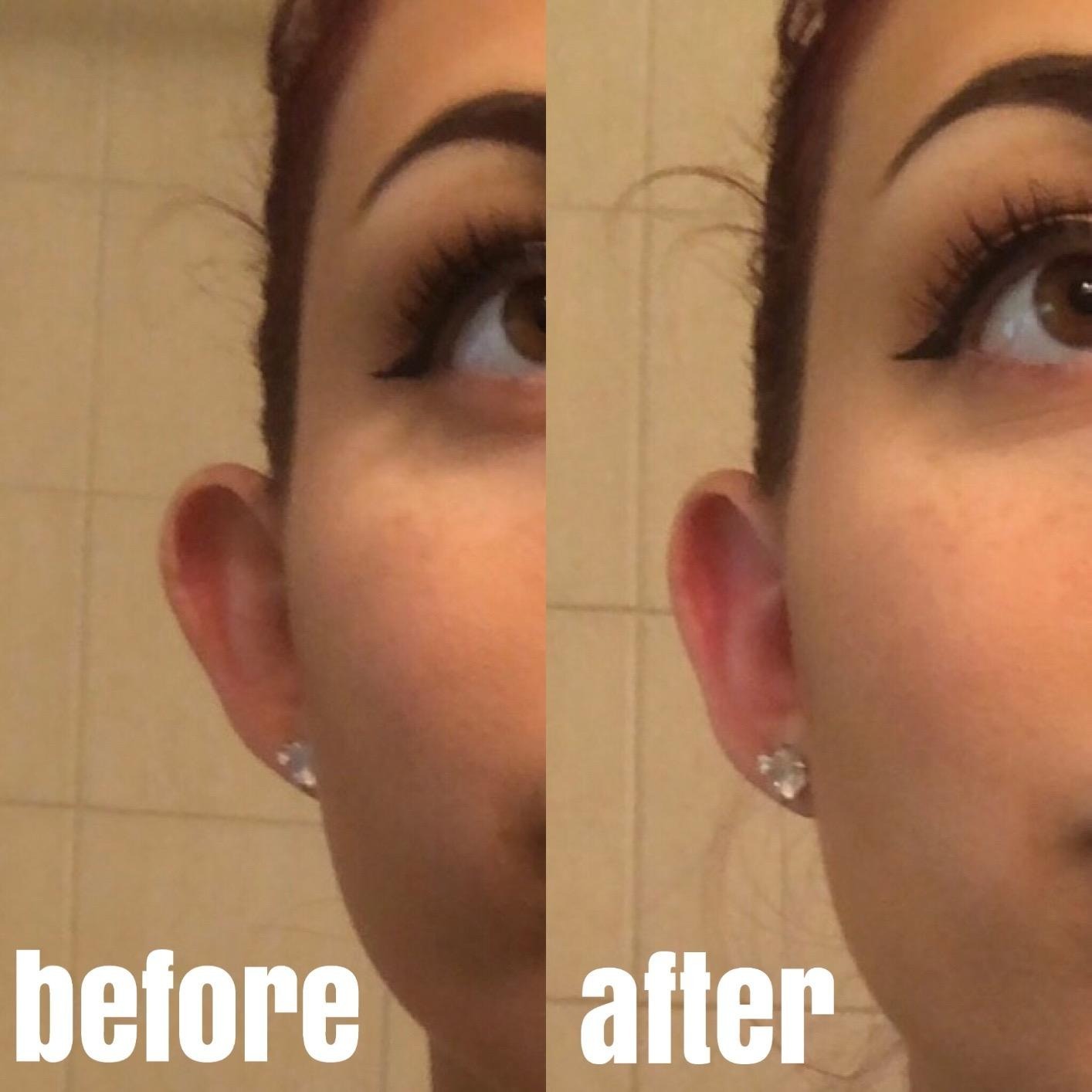 Ear Sticker Corrector Shape Waterproof Ear Stickers