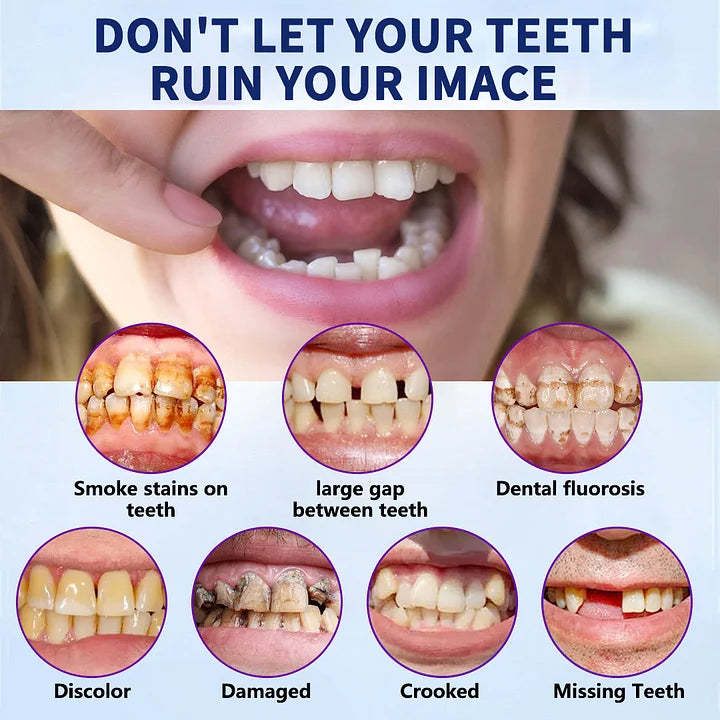 New Generation Flexible Full Denture Solution