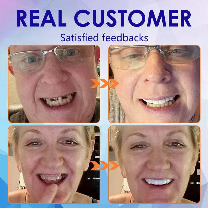 New Generation Flexible Full Denture Solution