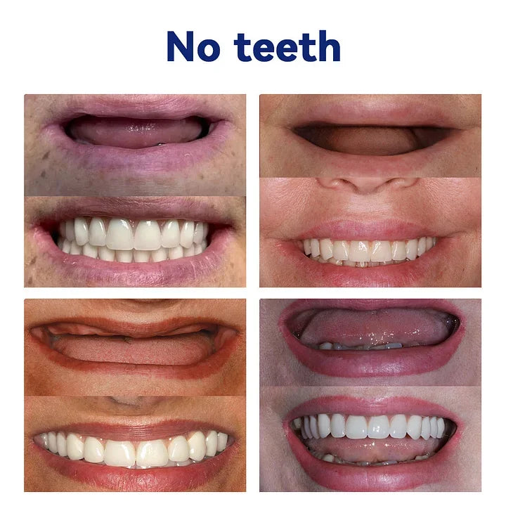 New Generation Flexible Full Denture Solution