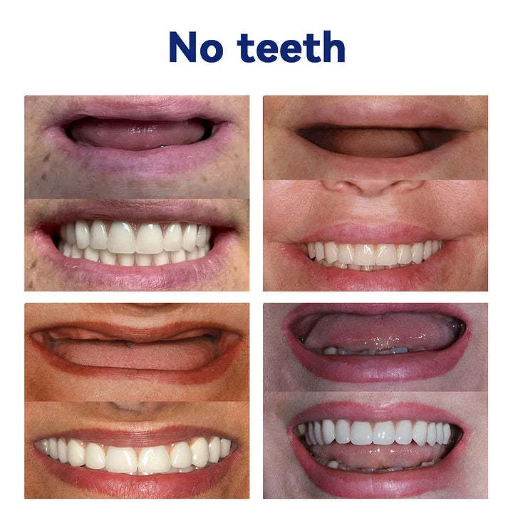 New Generation Flexible Full Denture Solution