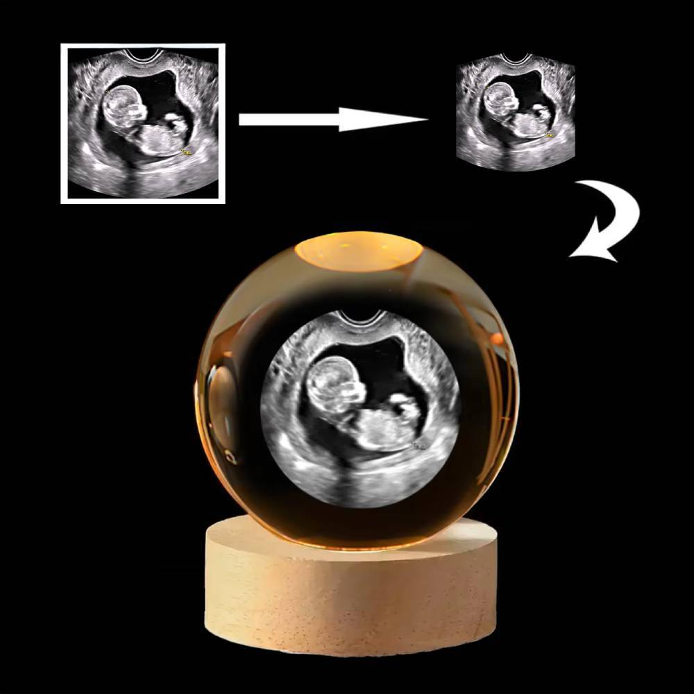 Individuelles B-ultraschallfoto 3d-kristallkugel Hält Babys Erste Ultraschall-erinnerungen Fest - meinemondlampe