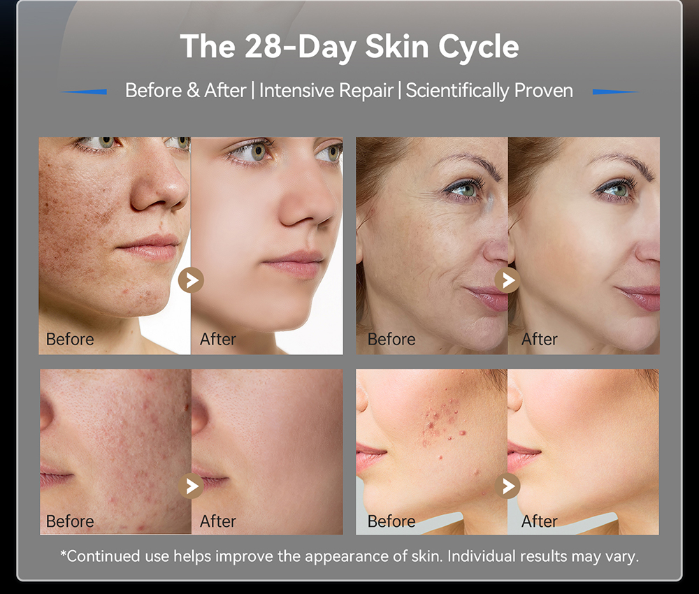 Dr.pen M9 Microneedling Pen 2.0